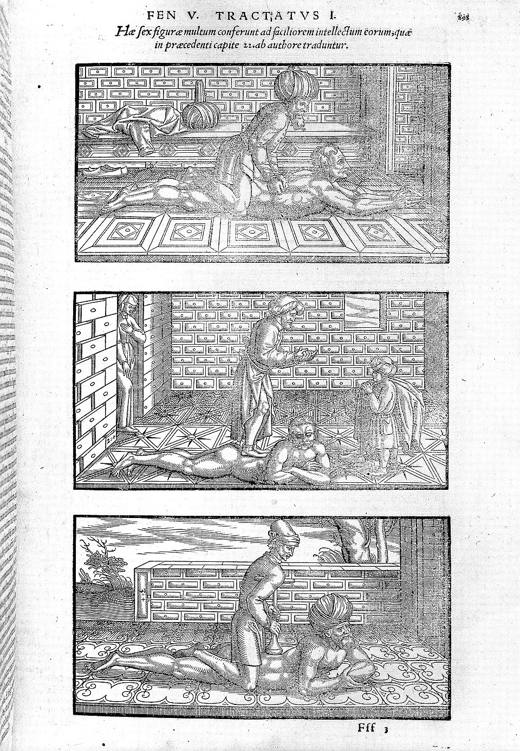 Houtsneden uit een gedrukte Latijnse uitgave van Avicenna's Canon, het leerboek van de Europese medische faculteiten.